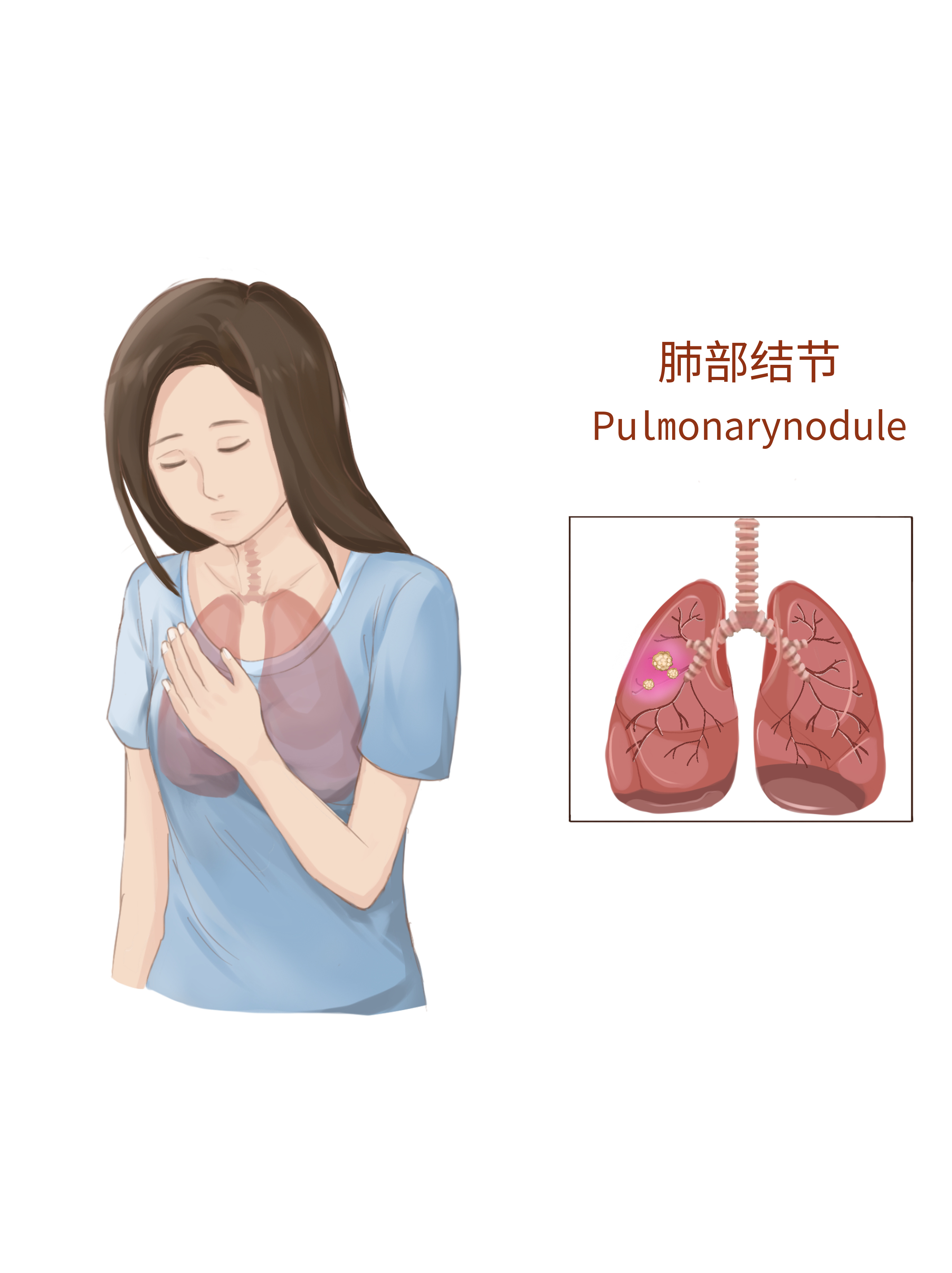 结节内有空洞？15岁男孩确诊…